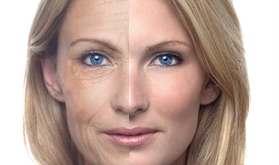 Eliminate wrinkles