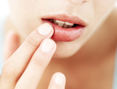 Lips of dead skin